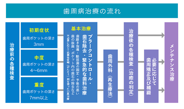 歯周病の治療の流れ